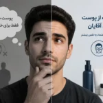 پوست صورت آقابان
